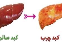 مبتلایان به کبد چرب کدام غذاها را نخورند؟