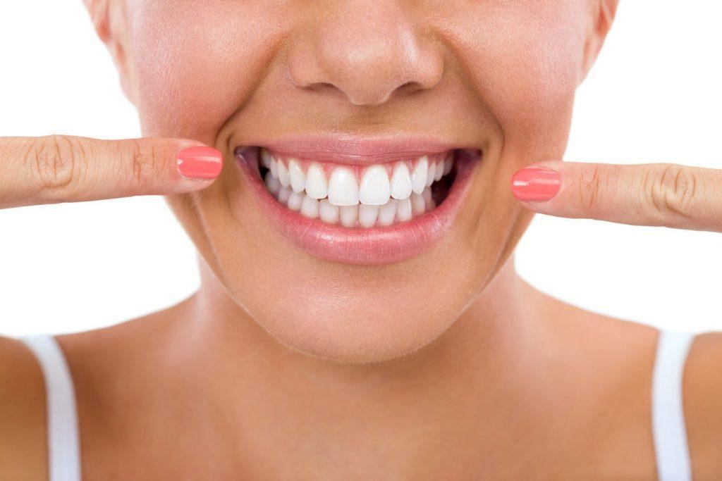 Porcelain Veneer in Iran| Dental Laminates cost | Hollywood Smile in Iran
